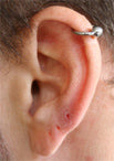 Piercings of the Cartilage