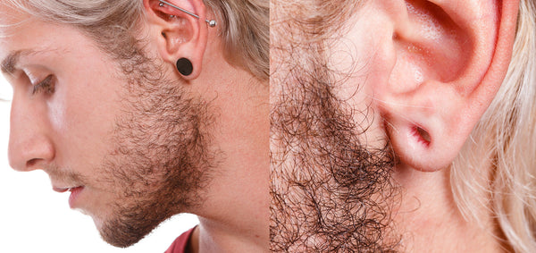 How to Close Stretched Earlobes at Home
